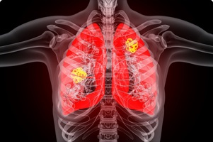 Cancer Research and Tumor Targeting